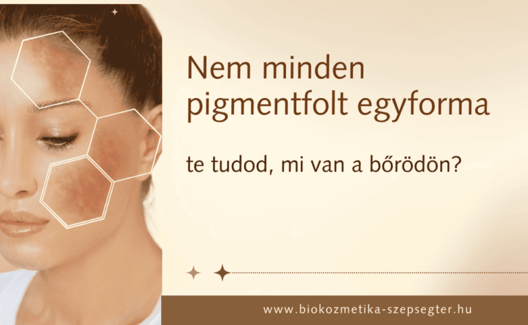 Nem minden pigmentfolt egyforma. Te tudod, mi van a bőrödön?