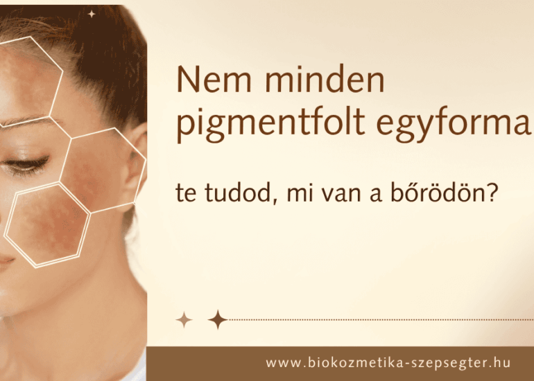 Nem minden pigmentfolt egyforma. Te tudod, mi van a bőrödön?