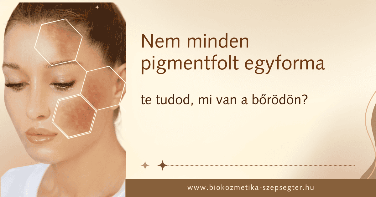 Nem minden pigmentfolt egyforma. Te tudod, mi van a bőrödön?